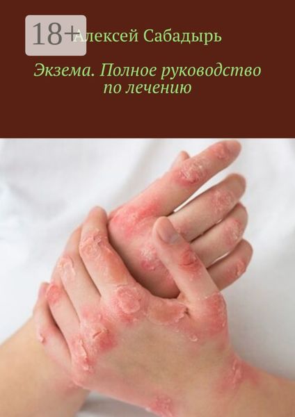 Экзема. Полное руководство по лечению